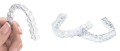 invisalign-img02